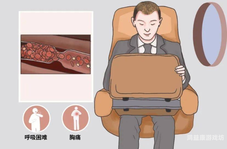 34岁女子坐8小时高铁后诱发肺栓塞，久坐不动需警惕经济舱综合征