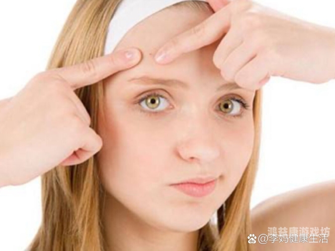 痘痘去除攻略，效果显著的有效方法痘痘该如何去除效果好一点