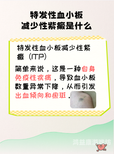 血小板减少性紫癜能根治吗？