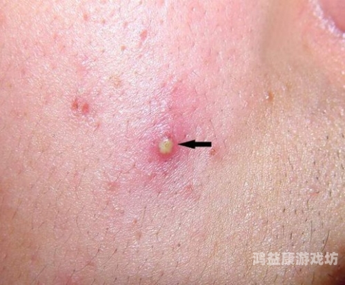 镜子中的口水，白色液体究竟为何？