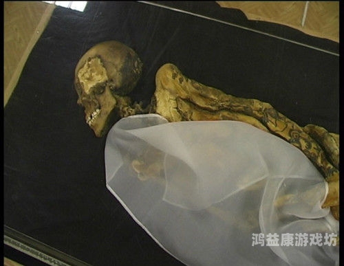 gyno日本妇科检查视频，探索女性水蜜桃在线播放的新视角日本妇科诊查