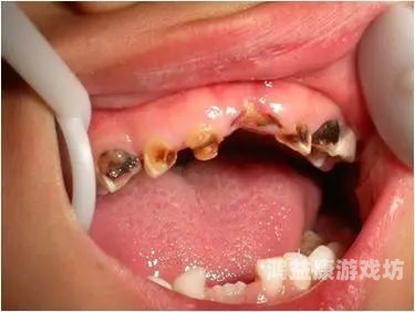 娇喘视频，揭秘胸大美女的神秘世界牙齿很多烂了怎么办